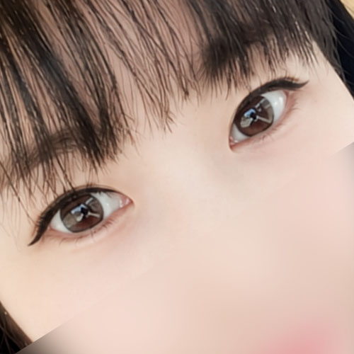 밑트임 후기