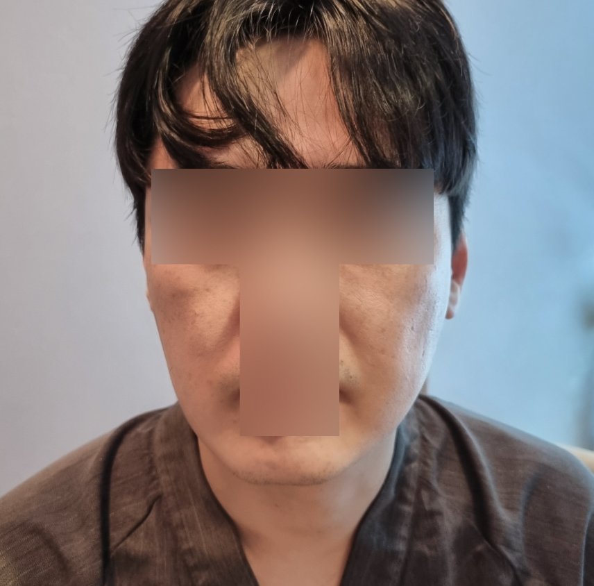 실리프팅 후기