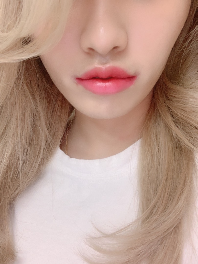 입꼬리성형 후기
