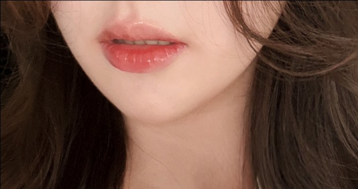 입꼬리성형 후기