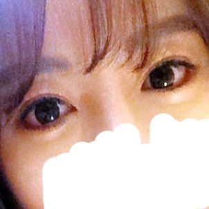 눈재수술 후기