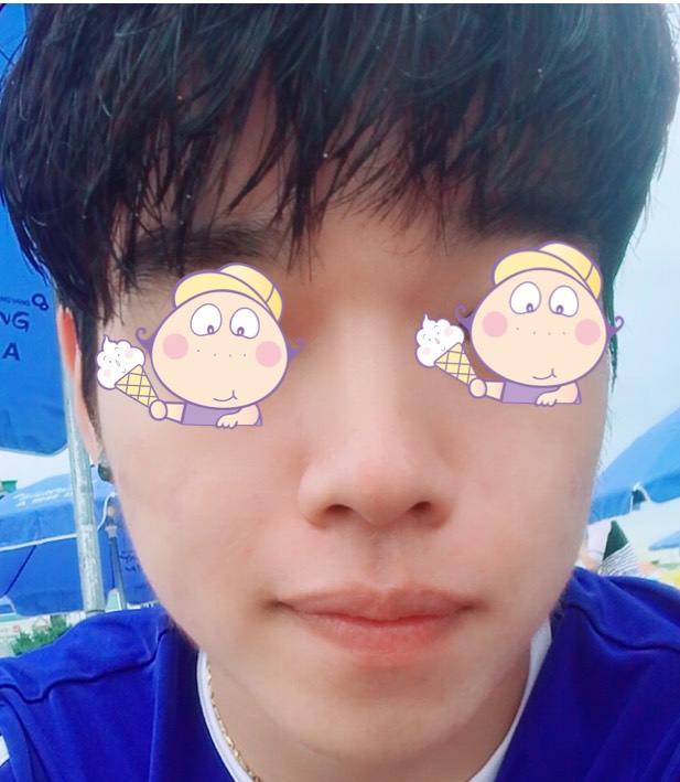 콧볼축소 후기