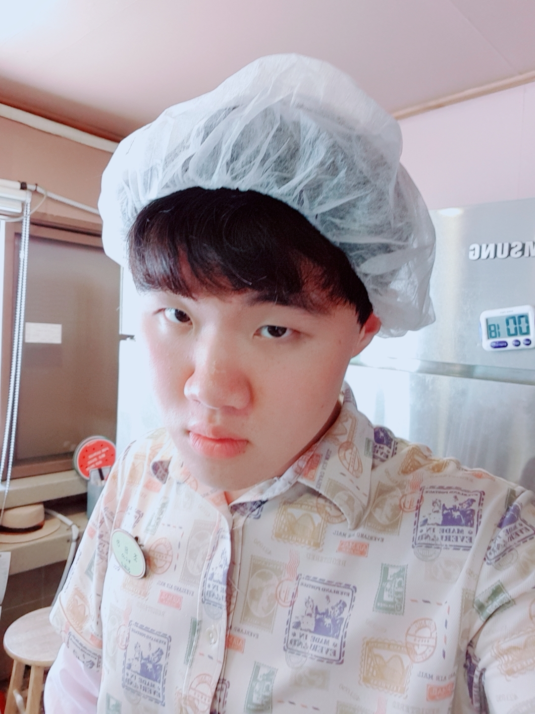 콧볼축소 후기