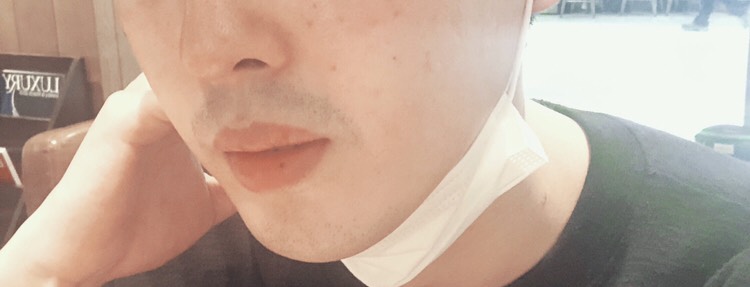 입꼬리성형 후기