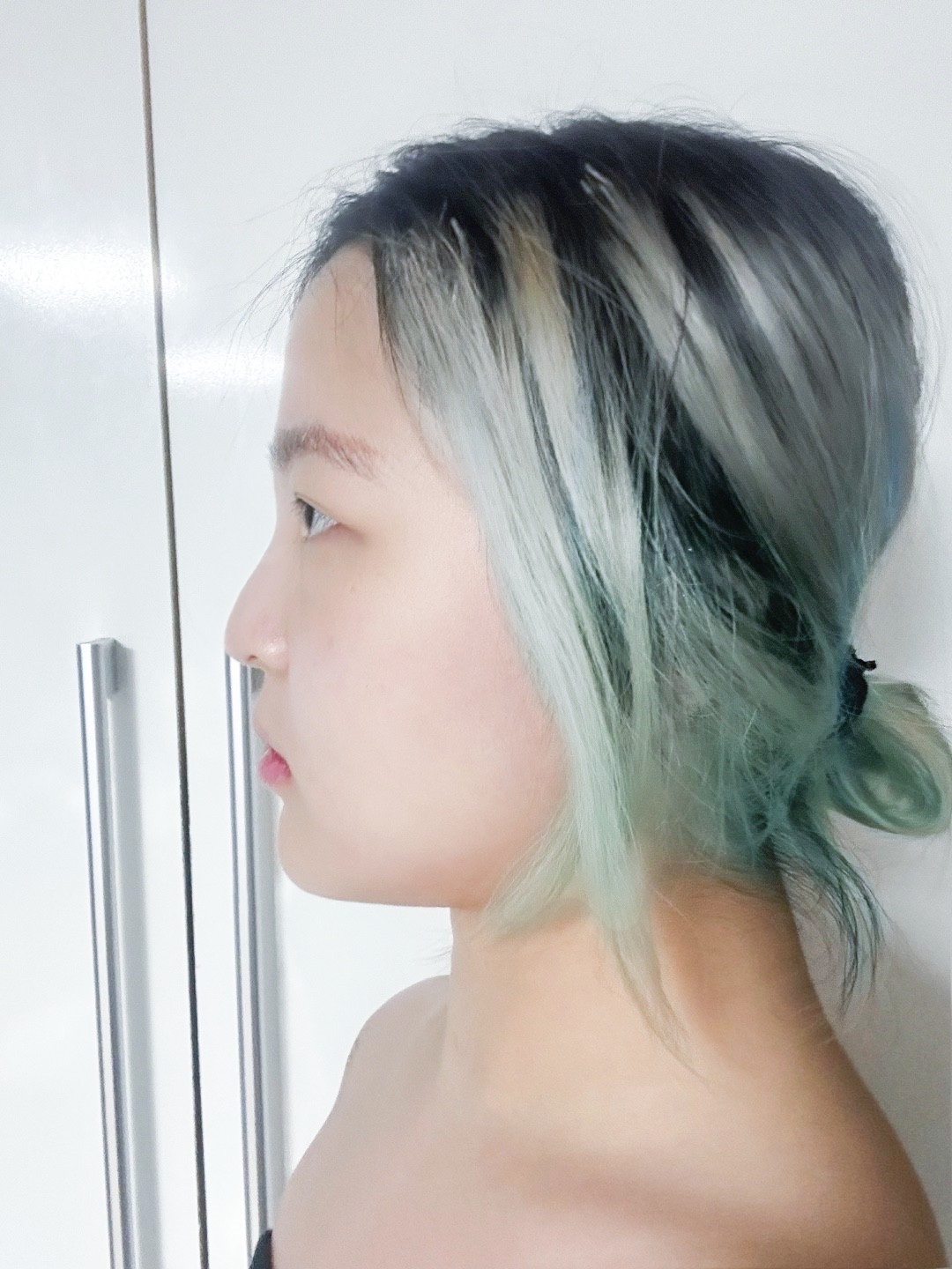 코끝(기증연골) 후기