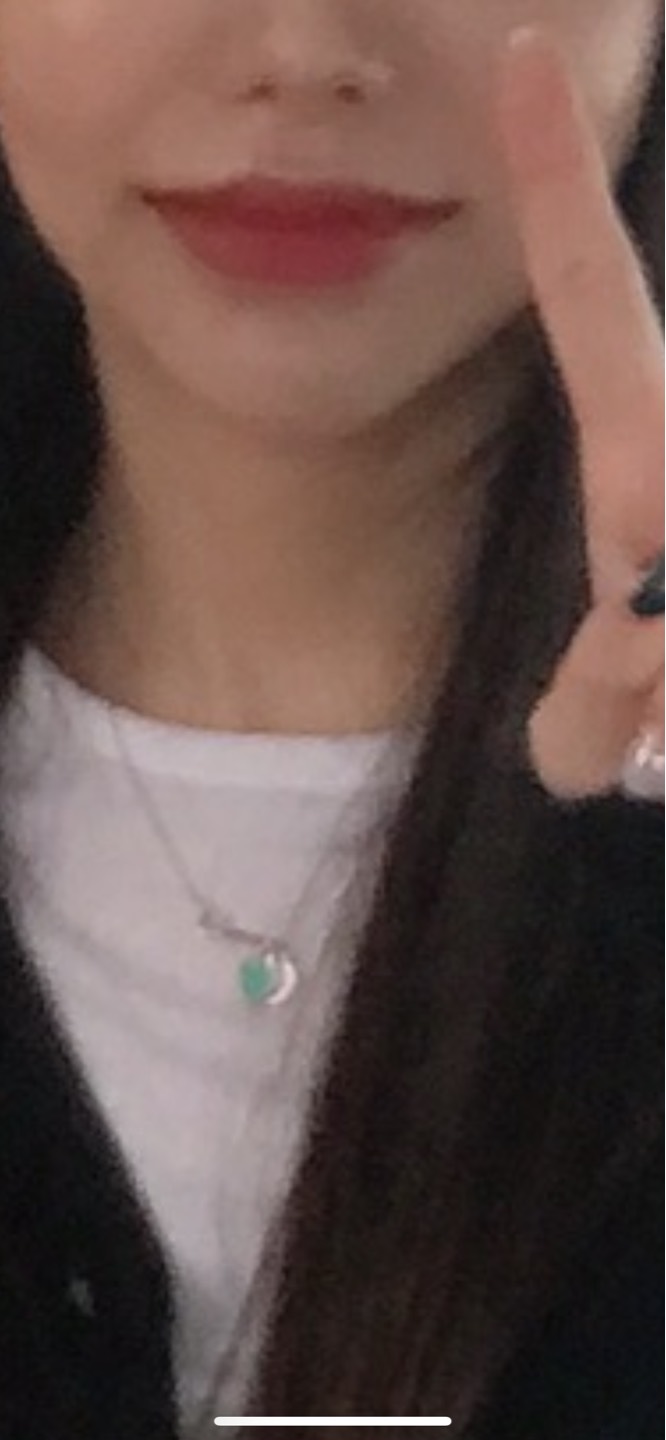 인중축소술 후기
