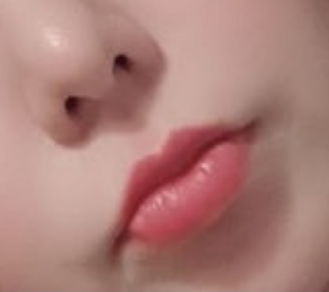 입꼬리성형 후기