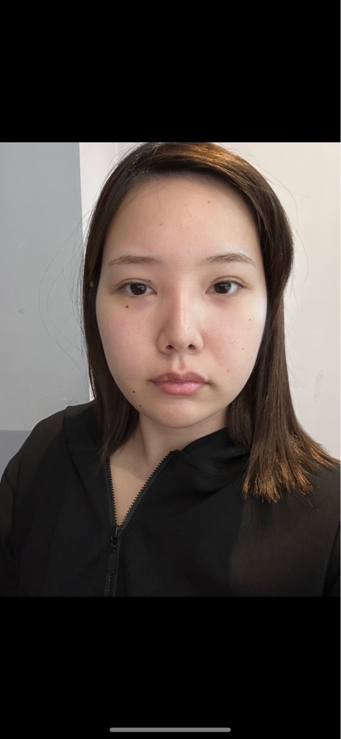 실리프팅 후기