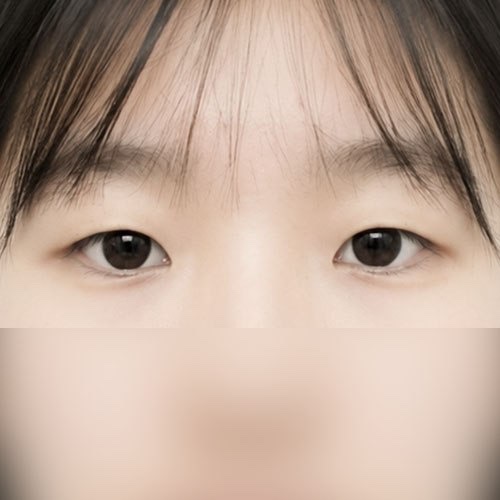 쌍꺼풀(자연유착) 후기