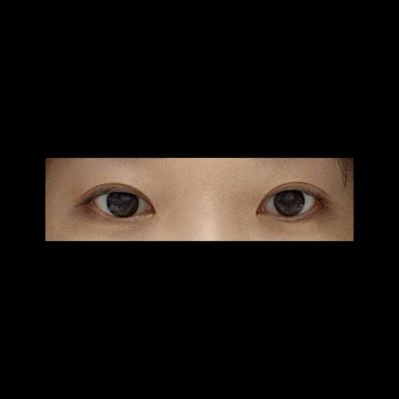 밑트임 후기