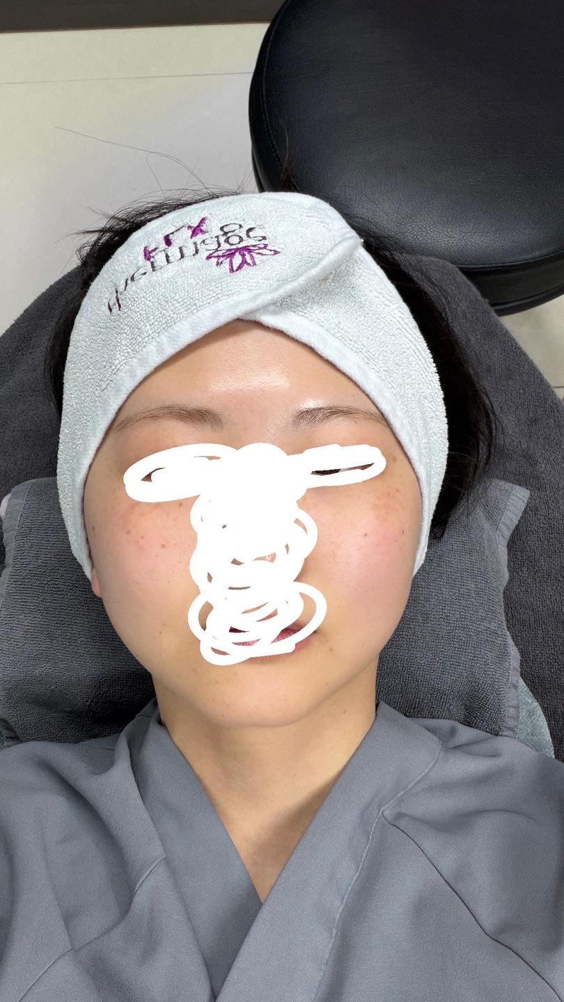 온다리프팅 후기
