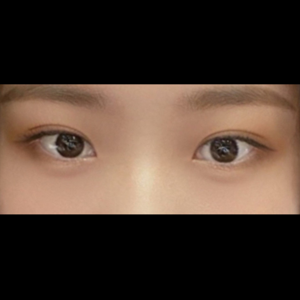 밑트임 후기