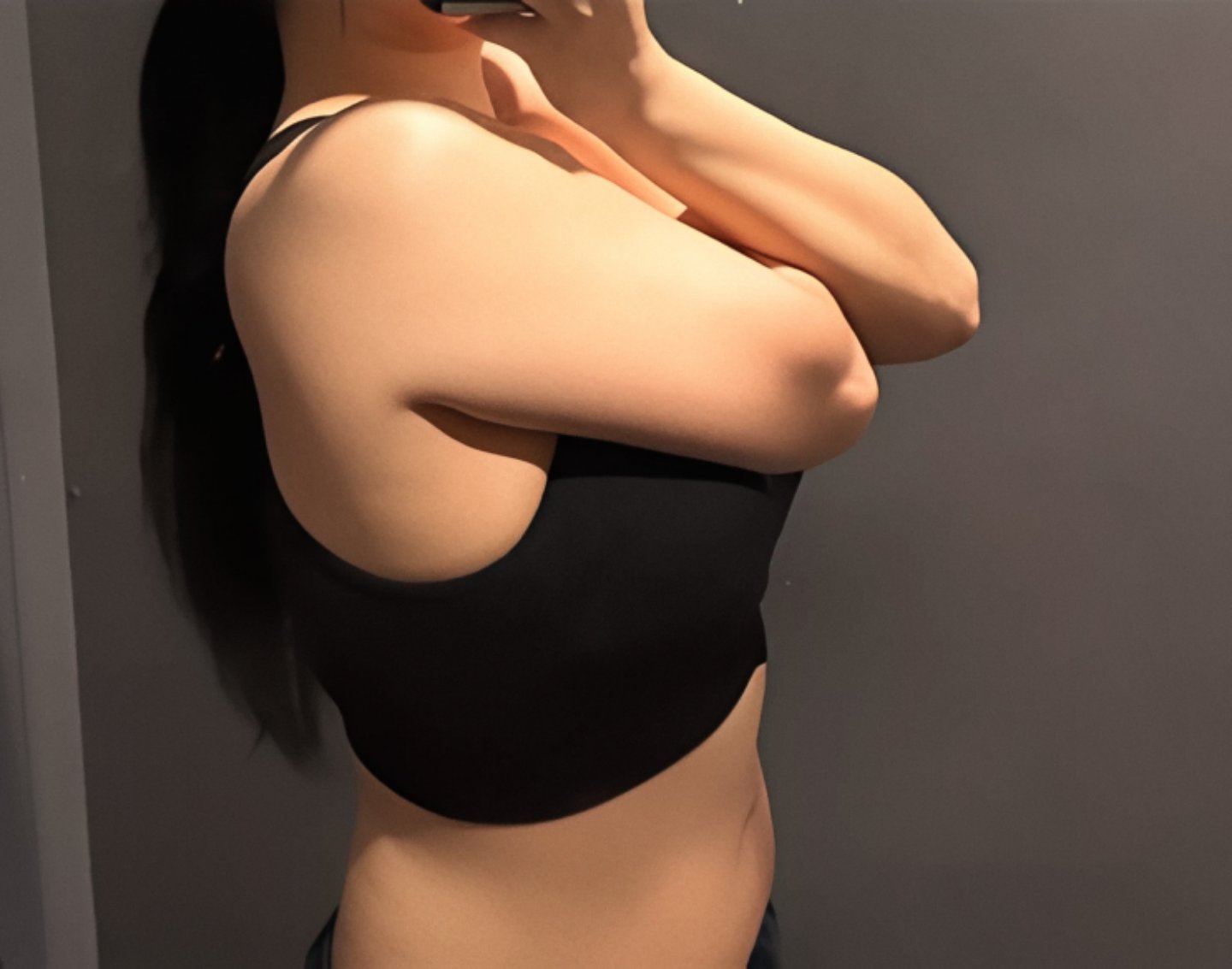 팔지방흡입 후기