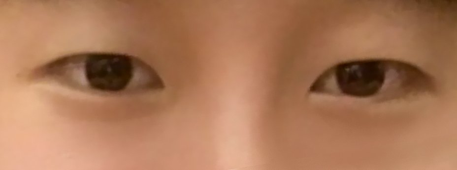 밑트임 후기