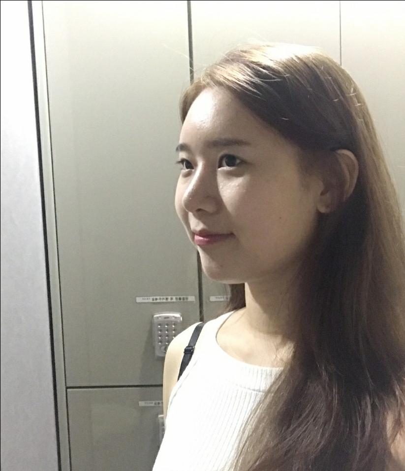 비중격만곡증수술 후기
