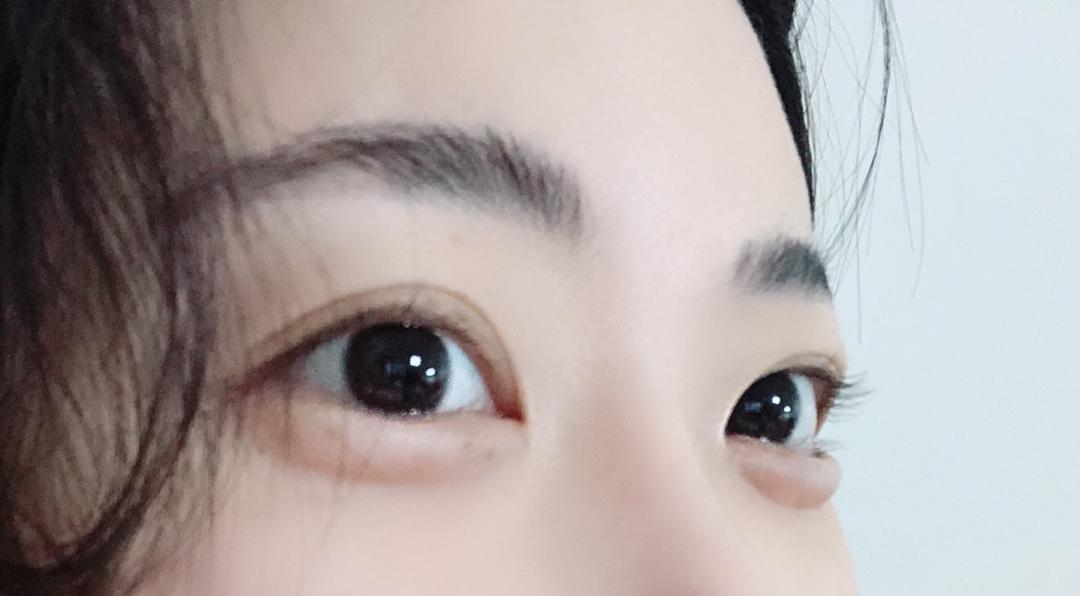 실리프팅 후기