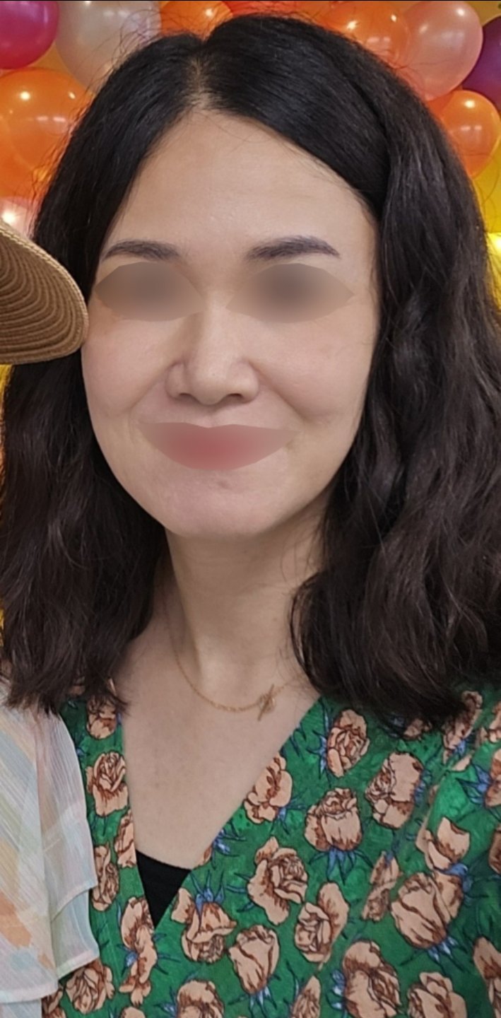 실리프팅 후기
