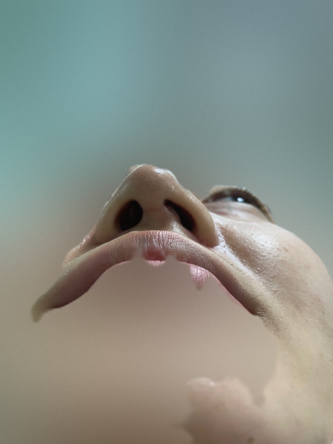 코재수술 후기