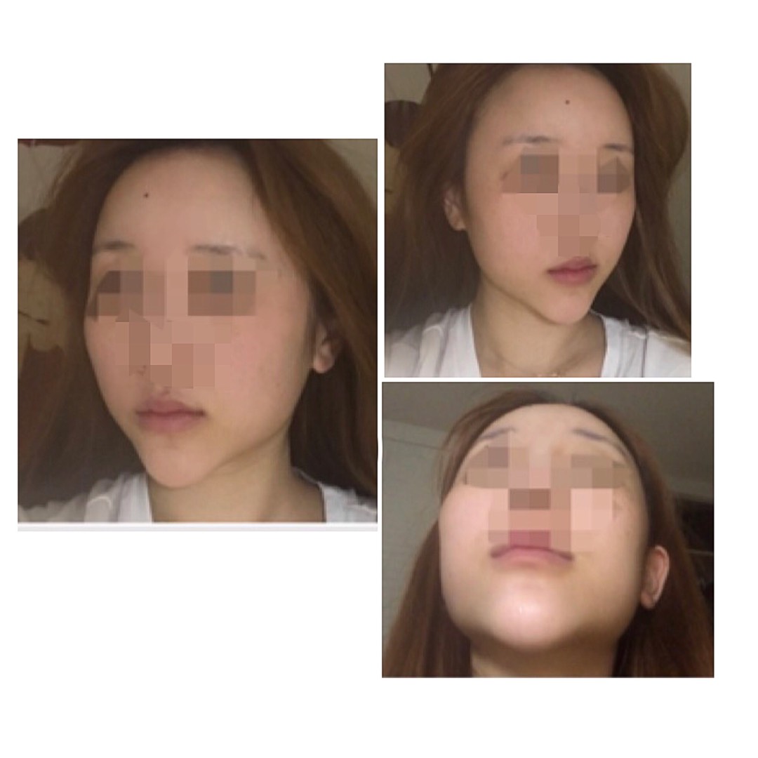 기타 후기