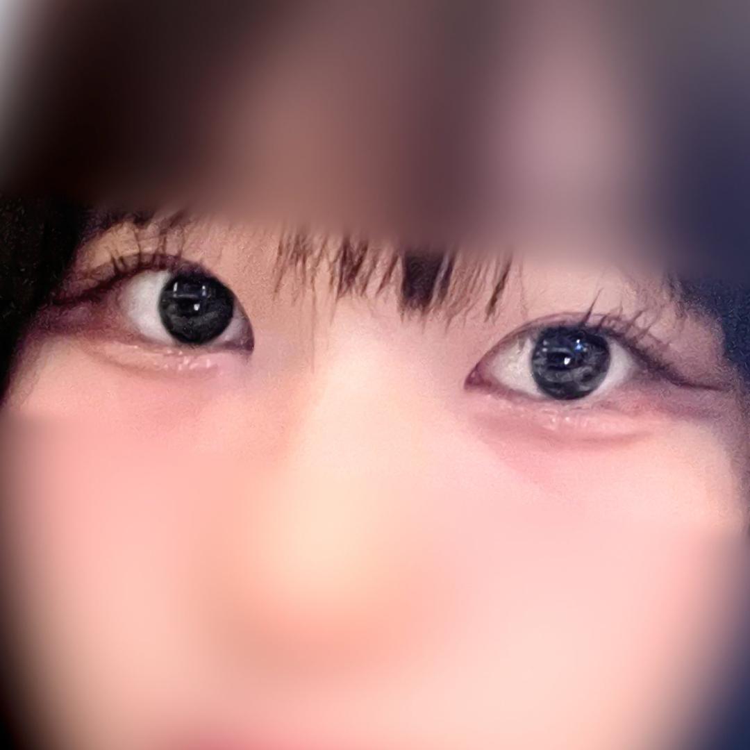밑트임 후기