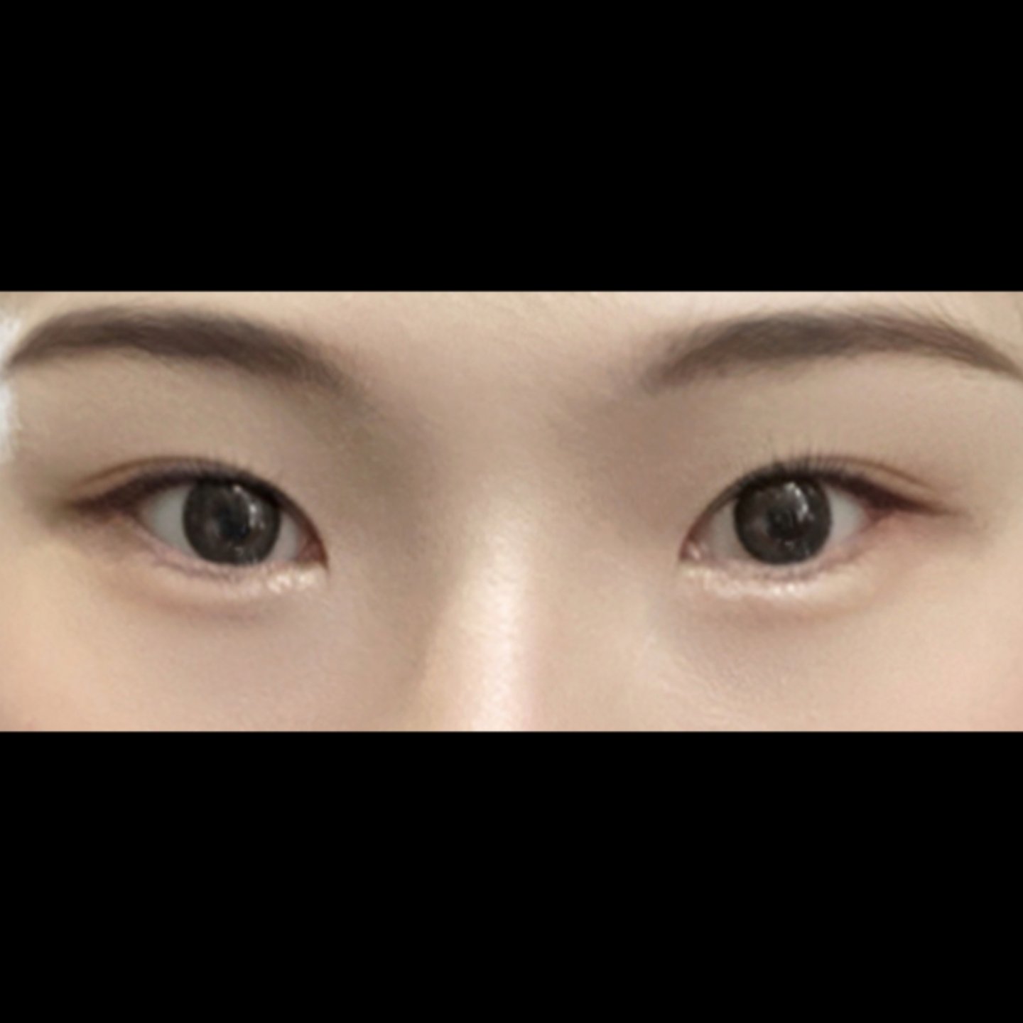 밑트임 후기