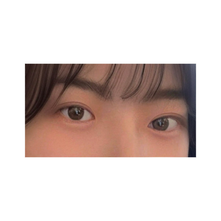 밑트임 후기