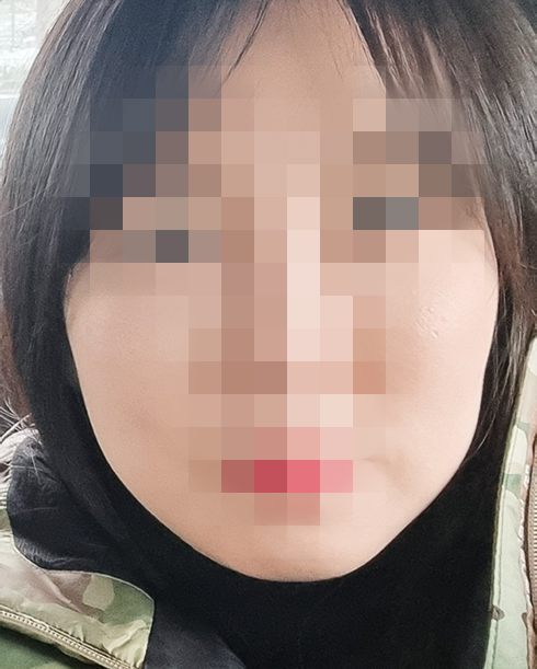 실리프팅 후기