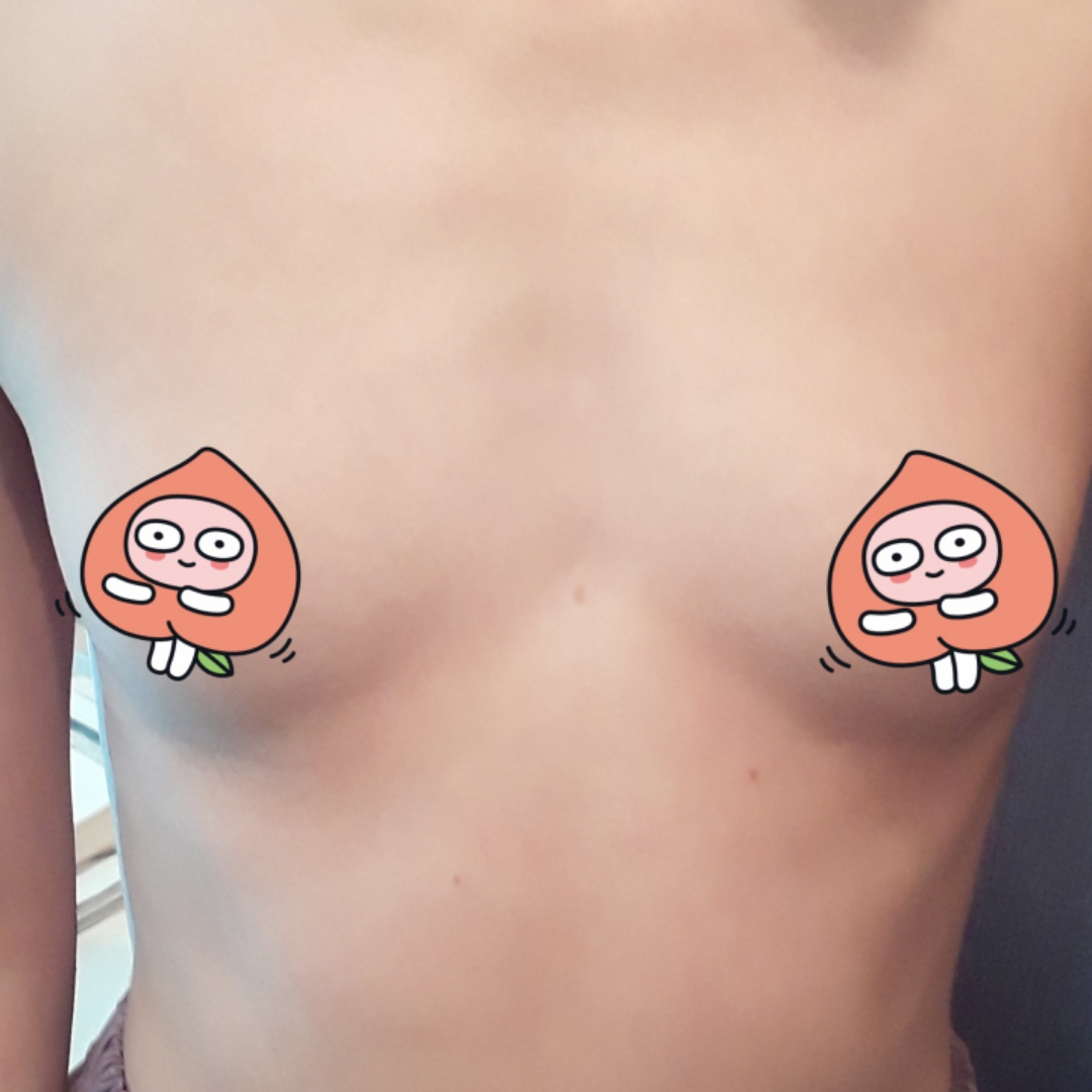 가슴(보형물) 후기