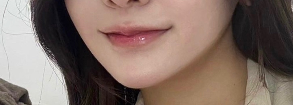 입꼬리성형 후기