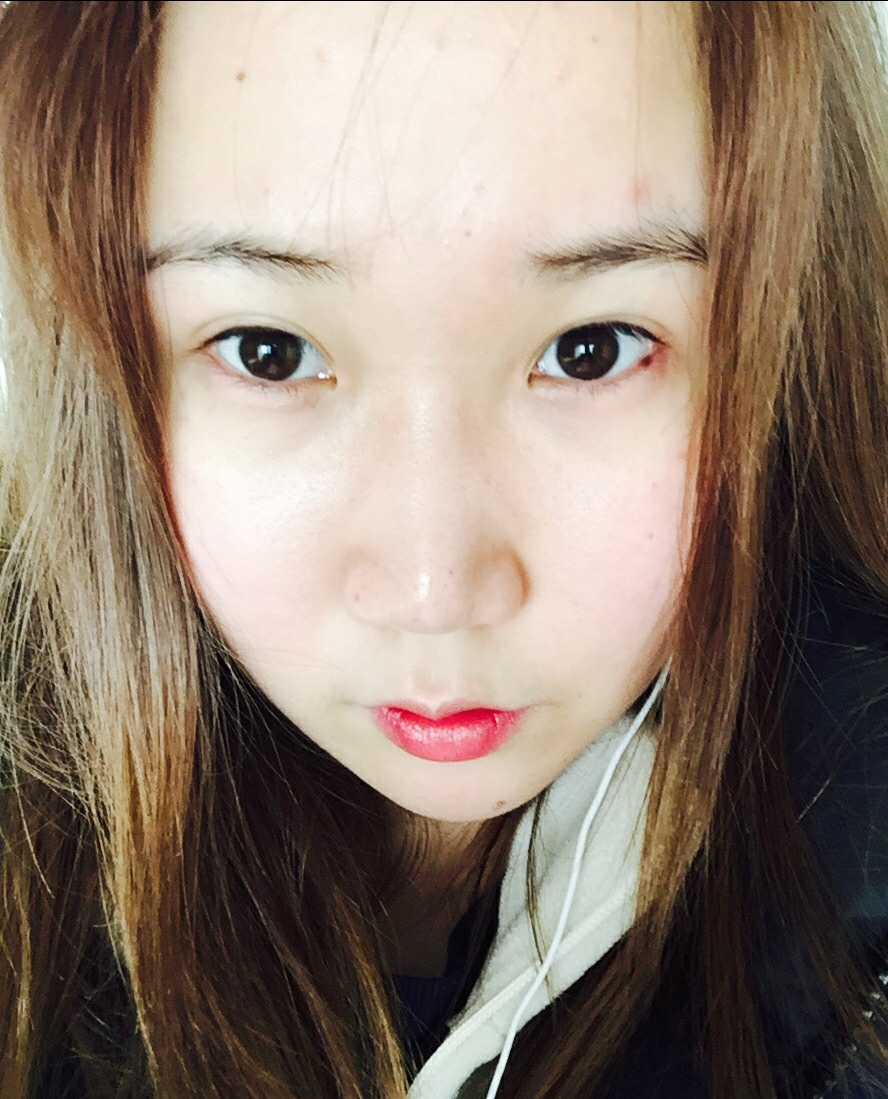 콧볼보톡스 후기
