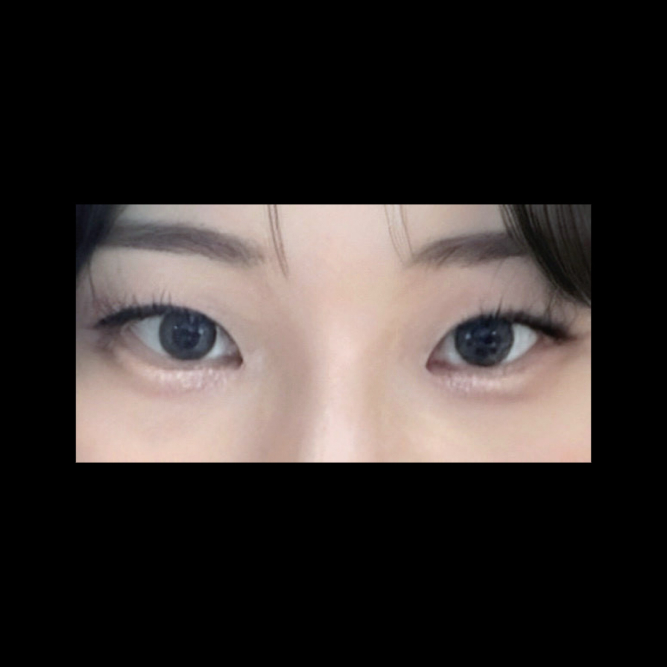 밑트임 후기