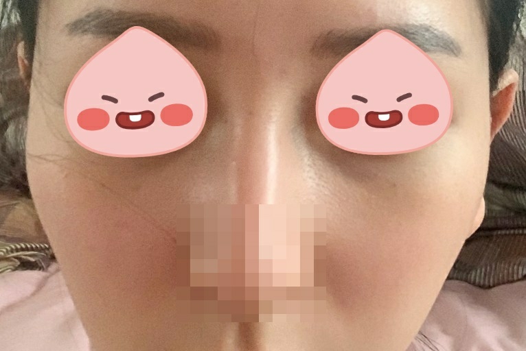 광대축소(전체) 후기