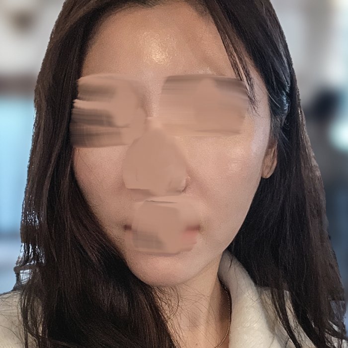 실리프팅 후기