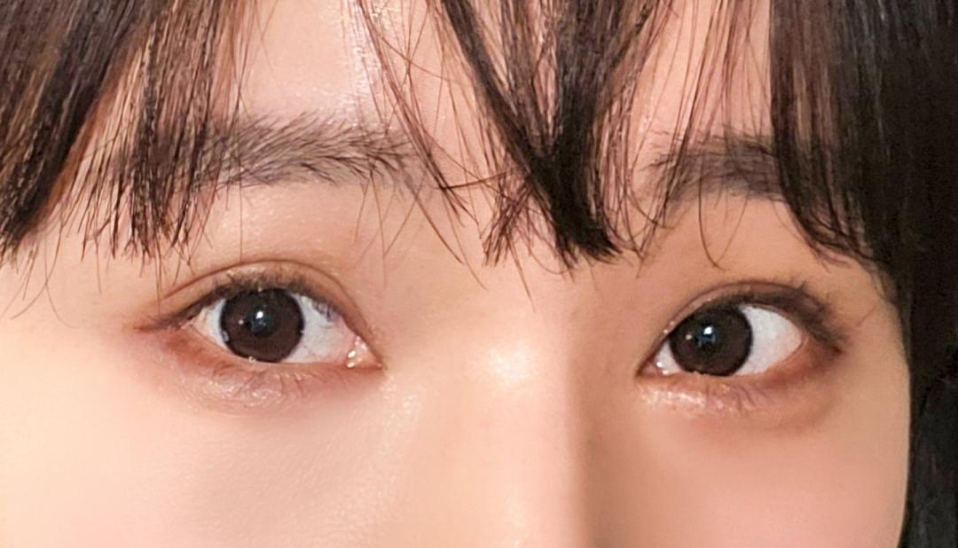 밑트임 후기