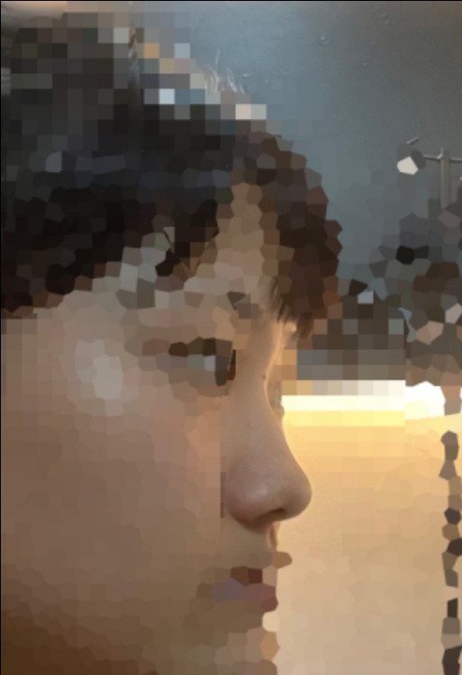 코길이연장술 후기