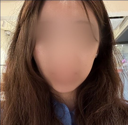 실리프팅 후기