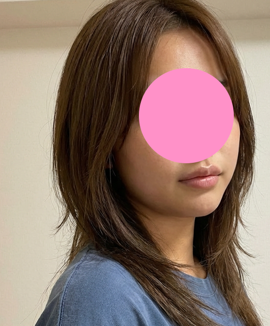 온다리프팅 후기