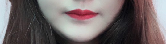 입꼬리성형 후기