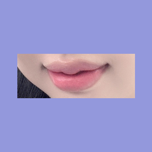 큐피트라인성형 후기