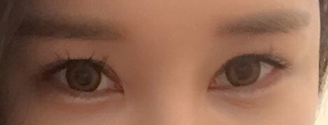 밑트임 후기