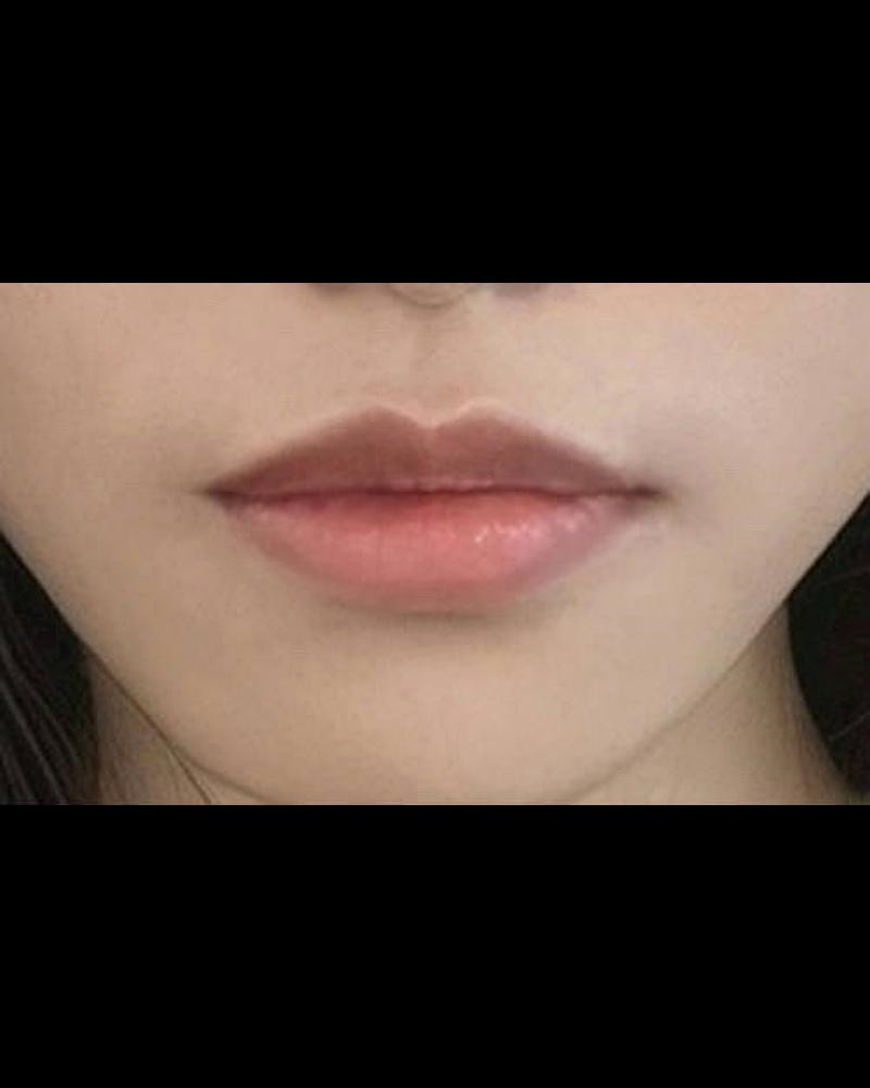 큐피트라인성형 후기