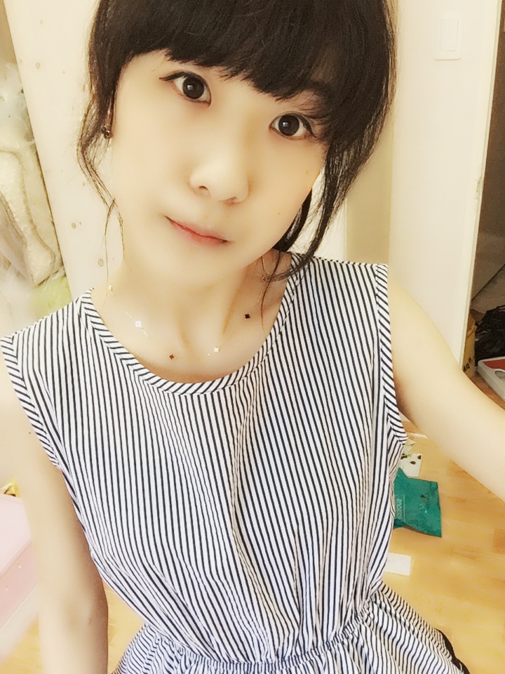입꼬리성형 후기