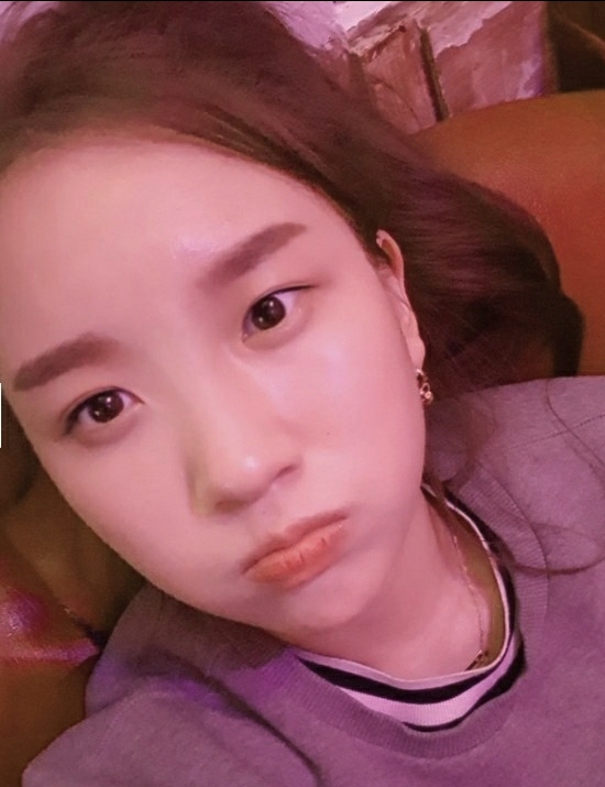 쌍꺼풀(절개) 후기