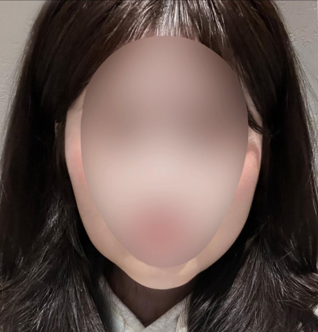 실리프팅 후기