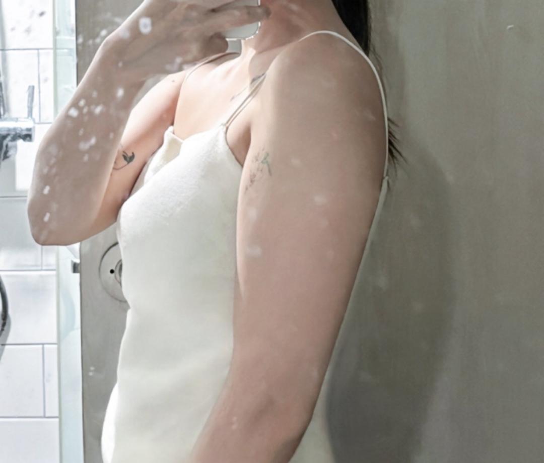 팔지방흡입 후기