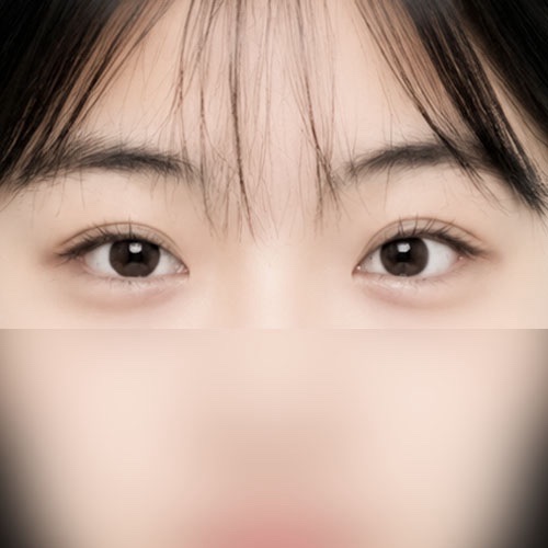 밑트임 후기