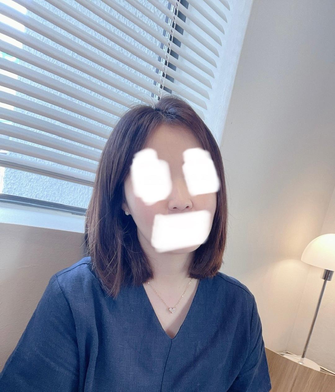 콧대(보형물) 후기