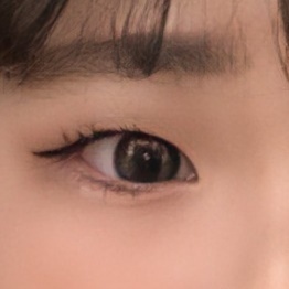 쌍꺼풀(절개) 후기