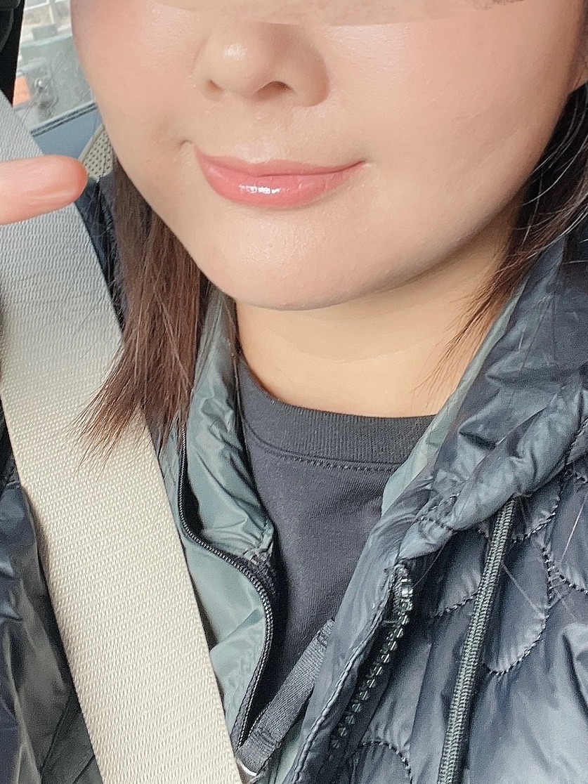 온다리프팅 후기