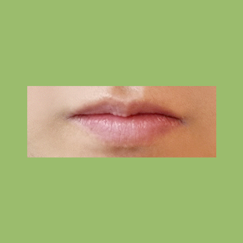큐피트라인성형 후기